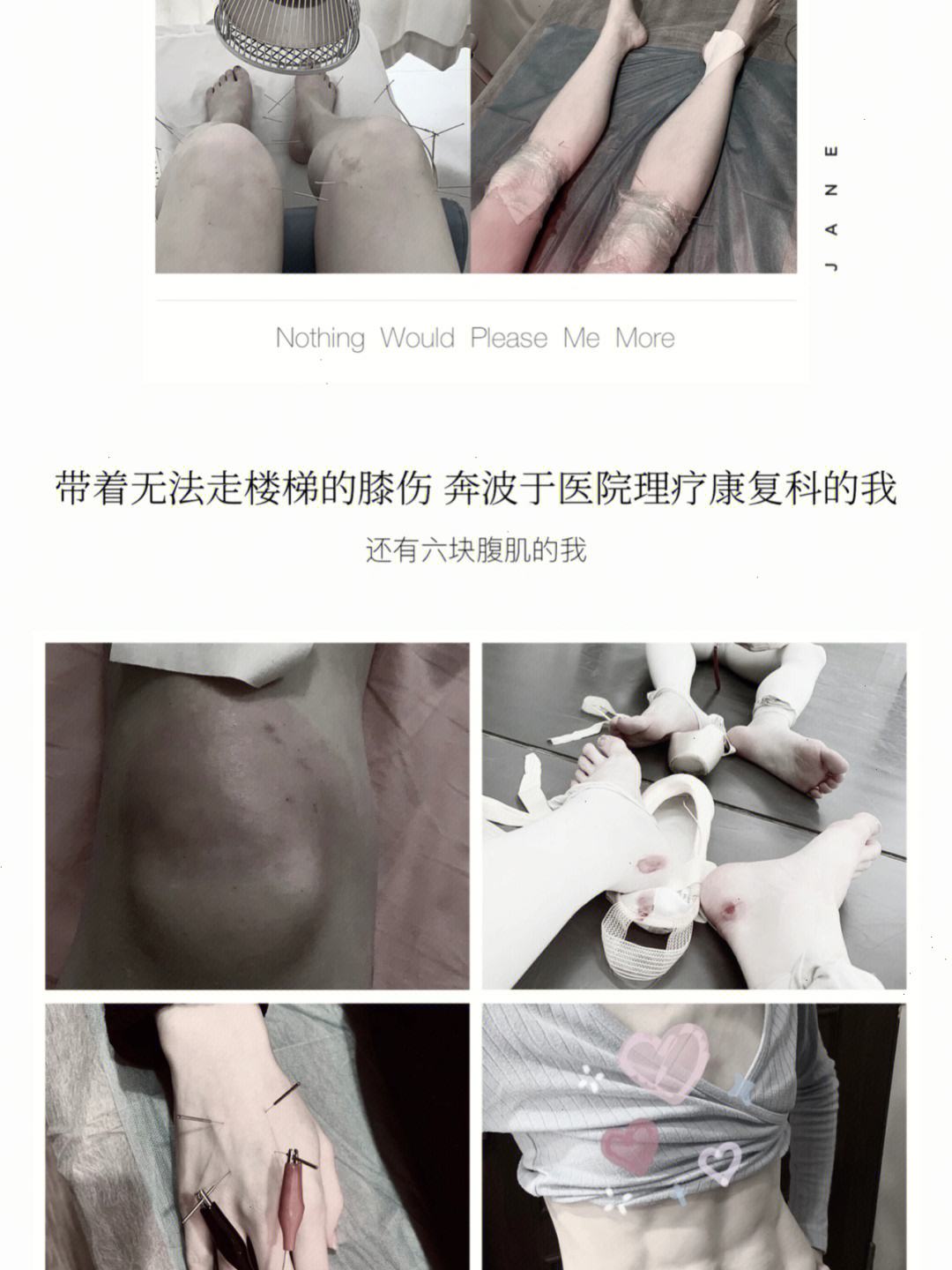 包含九游欢乐平台：中国篮球运动员伤病困扰，科学康复是关键的词条